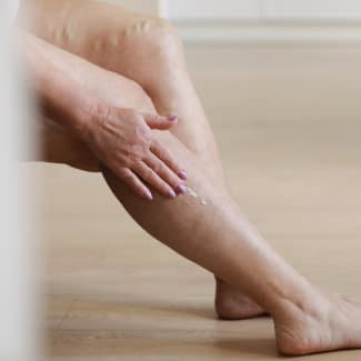 ​ Compressietherapie in de zorg: wanneer kousen echt verschil maken